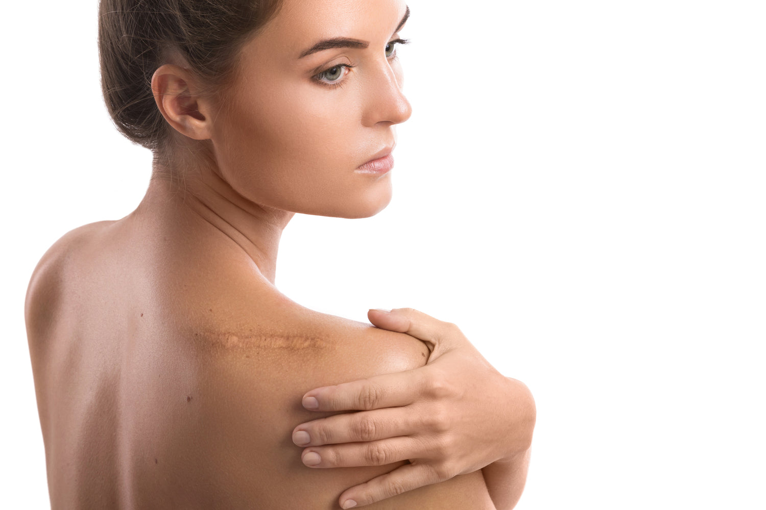 How Can I Get Rid of My Scars?
