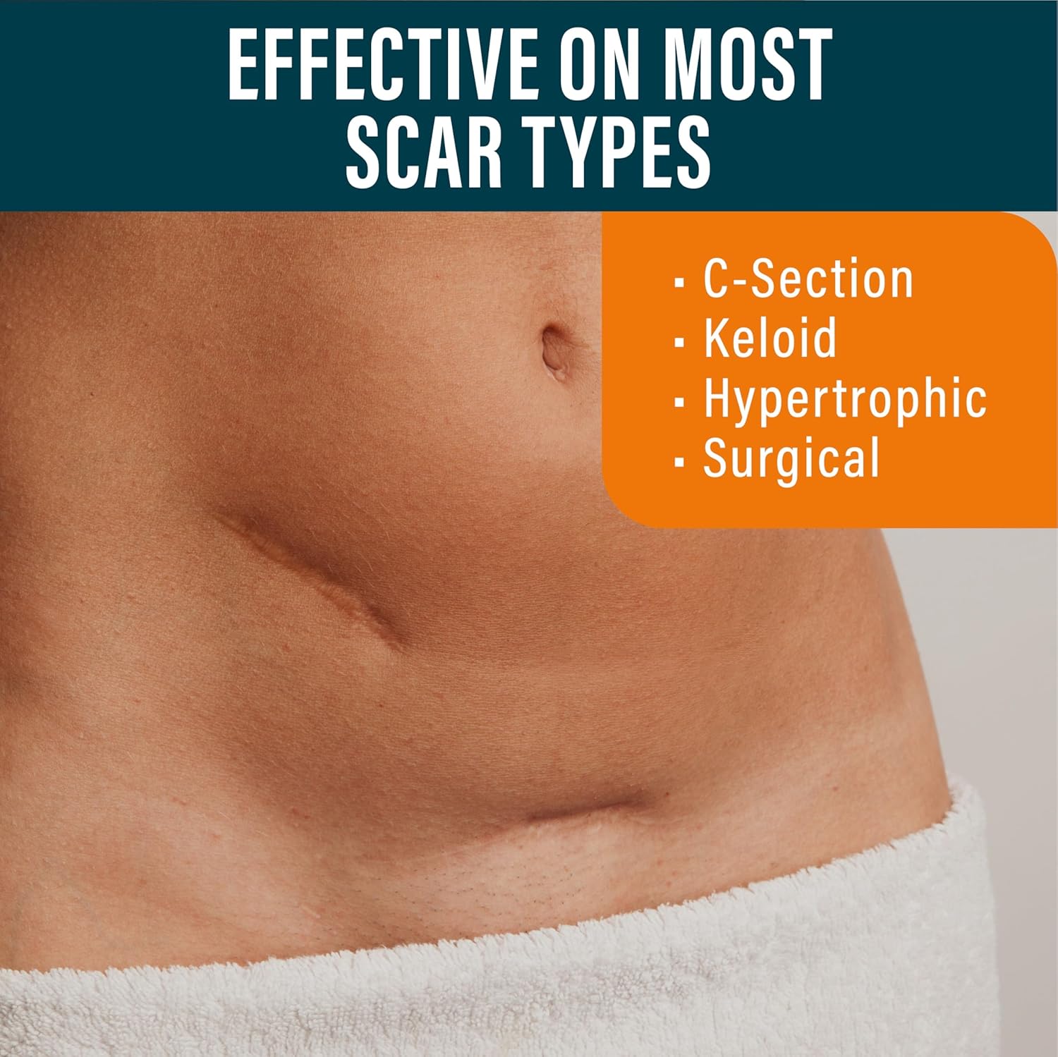 Effective on Most Scar Types