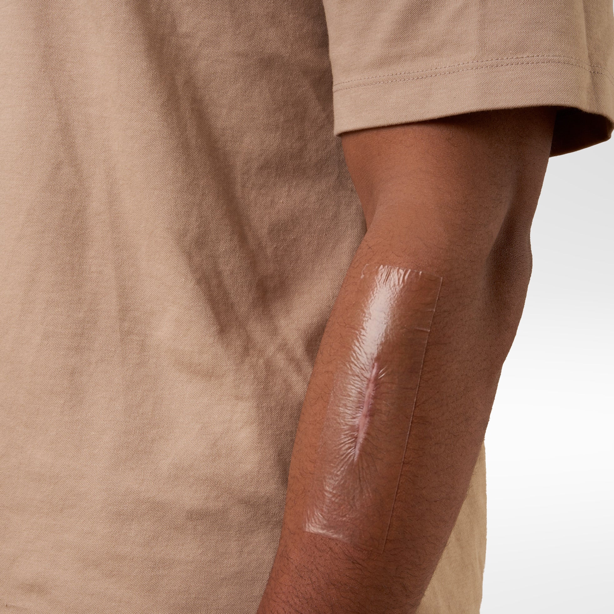 Silicone Scar Tape - Clear