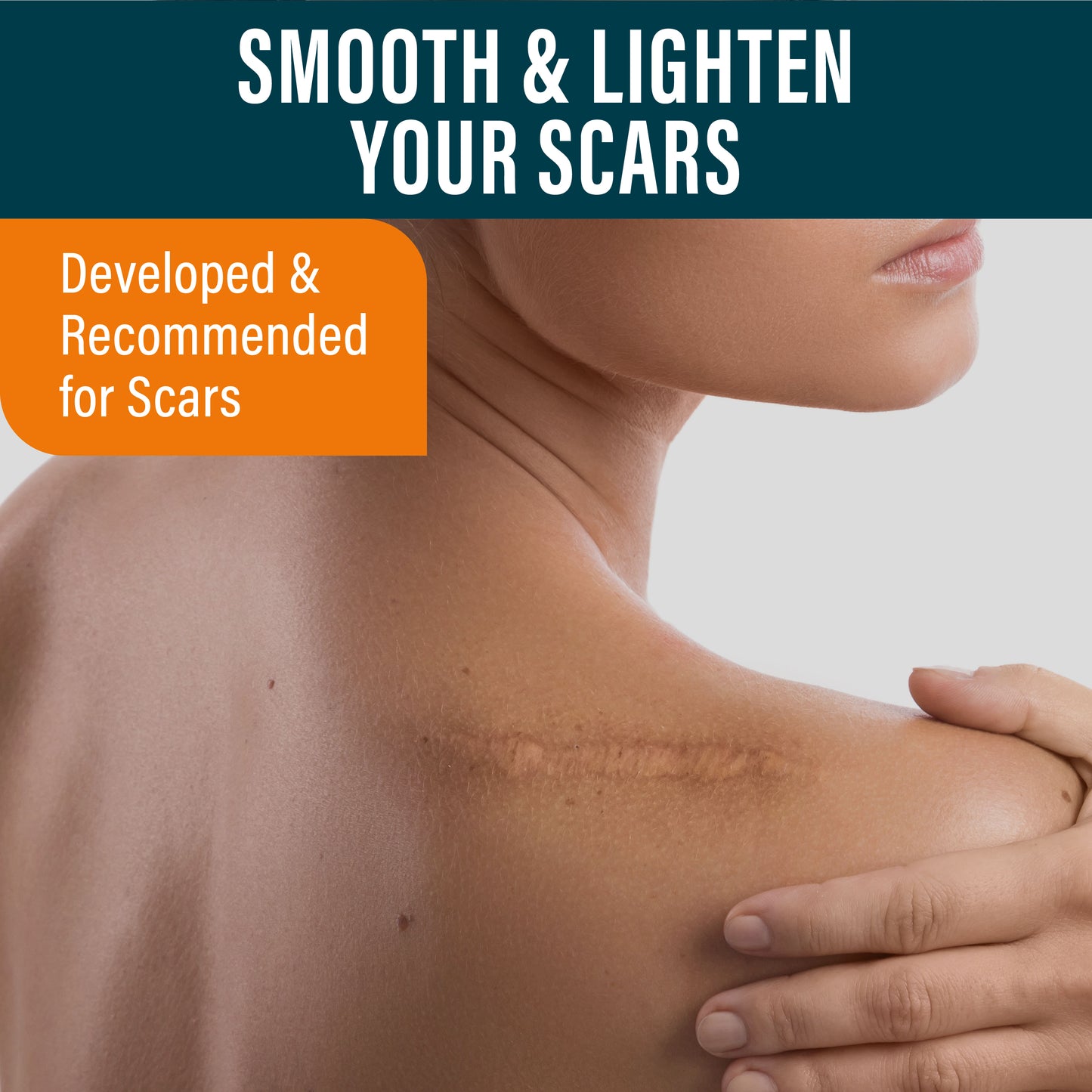 Advanced Scar Gel